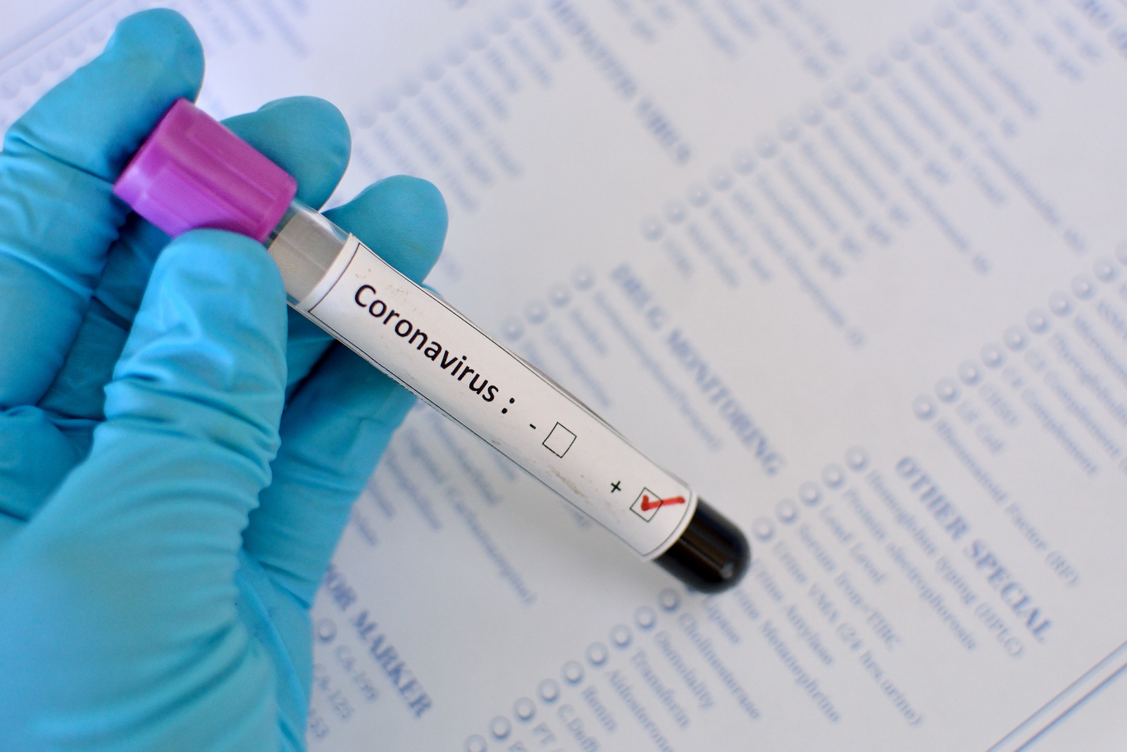 An AtHome Coronavirus Test Could Be Available To The