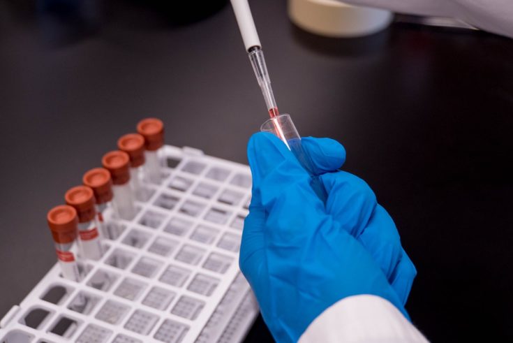 Coronavirus Testing Kits Heading To UK Contaminated With COVID-19